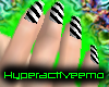 [HAE]Strp'dNails