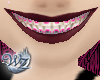 Braces in Pink (Def.) F