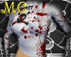 Bloody StraightJacket