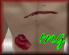! Wounded Back Male