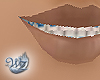 Braces in Blue (Jasmine)