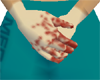 SURGICAL GLOVES BLOODY