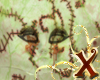 Rotten skin with infecte