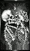 Till Death...